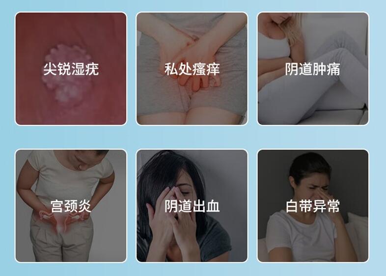 抗HPV婦用凝膠敷料，科技助力女性私密處護理
